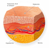 Hyaluronic Acid